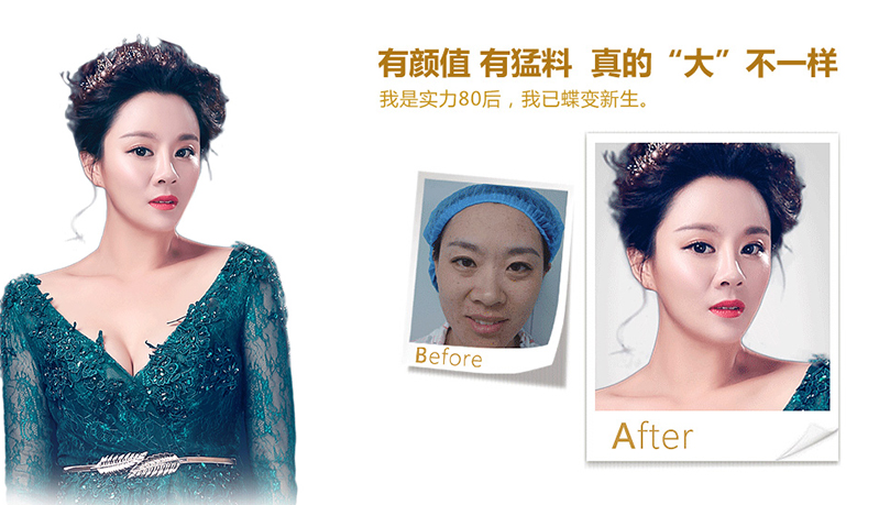 黔西南脂肪移植、隆鼻