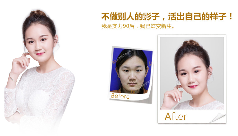 黔西南纳米脂肪移植