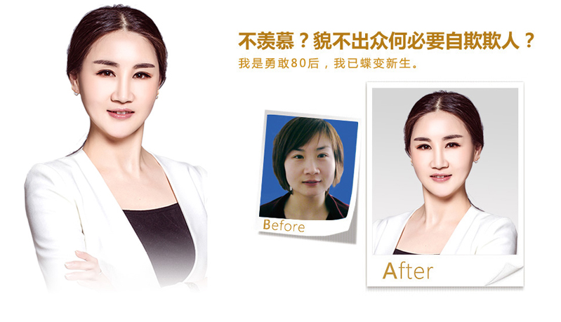 黔西南注射微雕