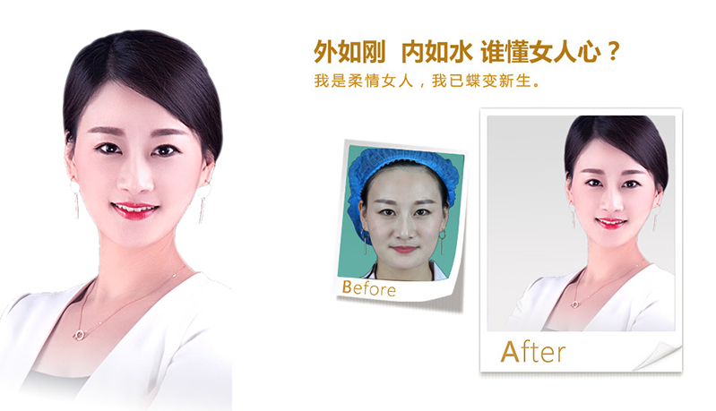 黔西南V脸、线雕隆鼻